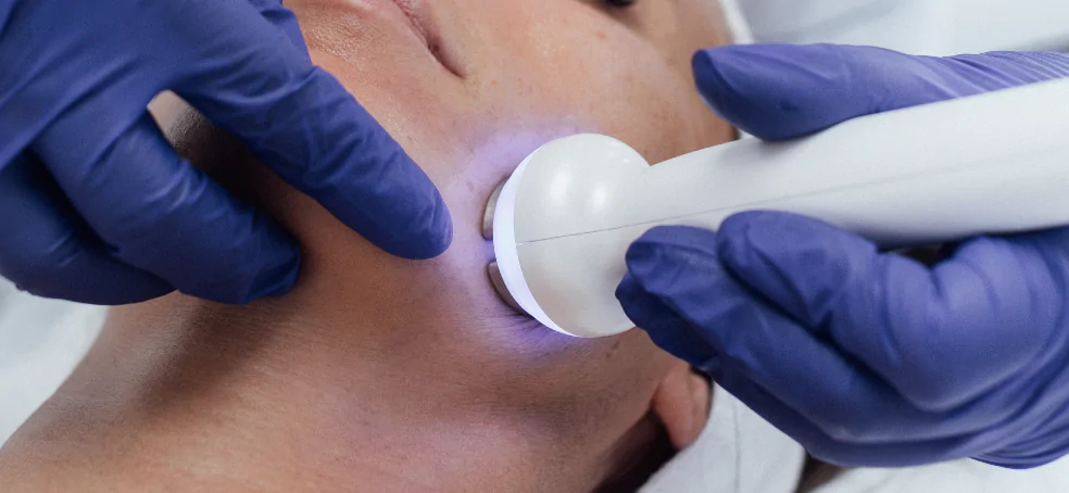 Hydrofacial