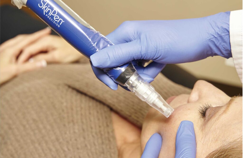 Skin Pen microneedling